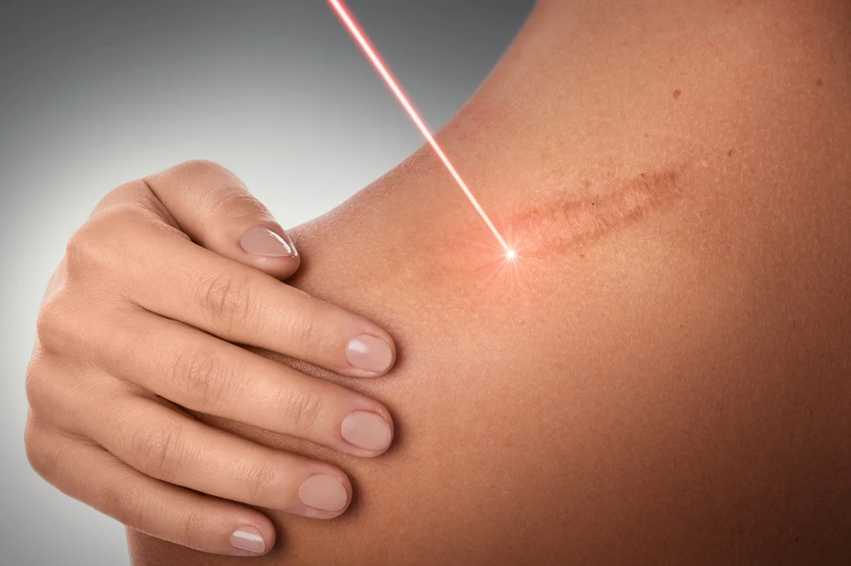 Hypertrophic-regenerative-aesthetics-and-dermatology-laguna-hills-ca