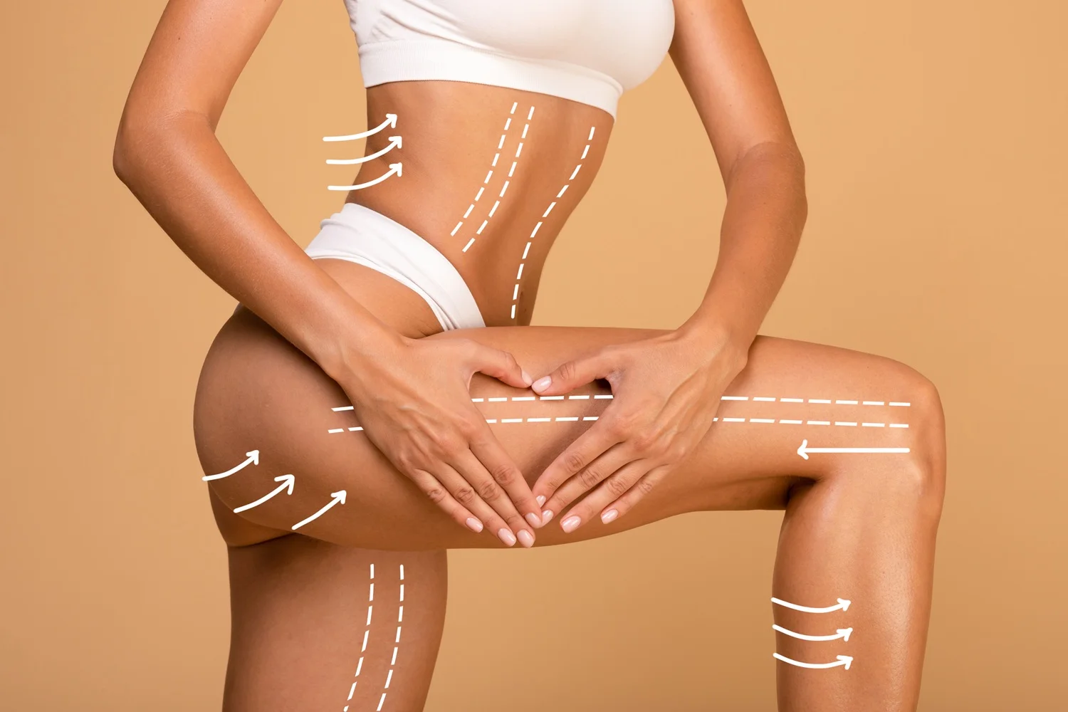 BodyTite Skin Tightening Laguna Hills
