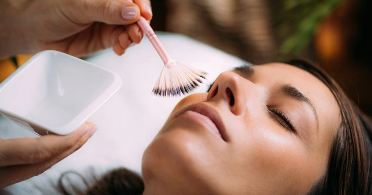 benefits of chemical peels