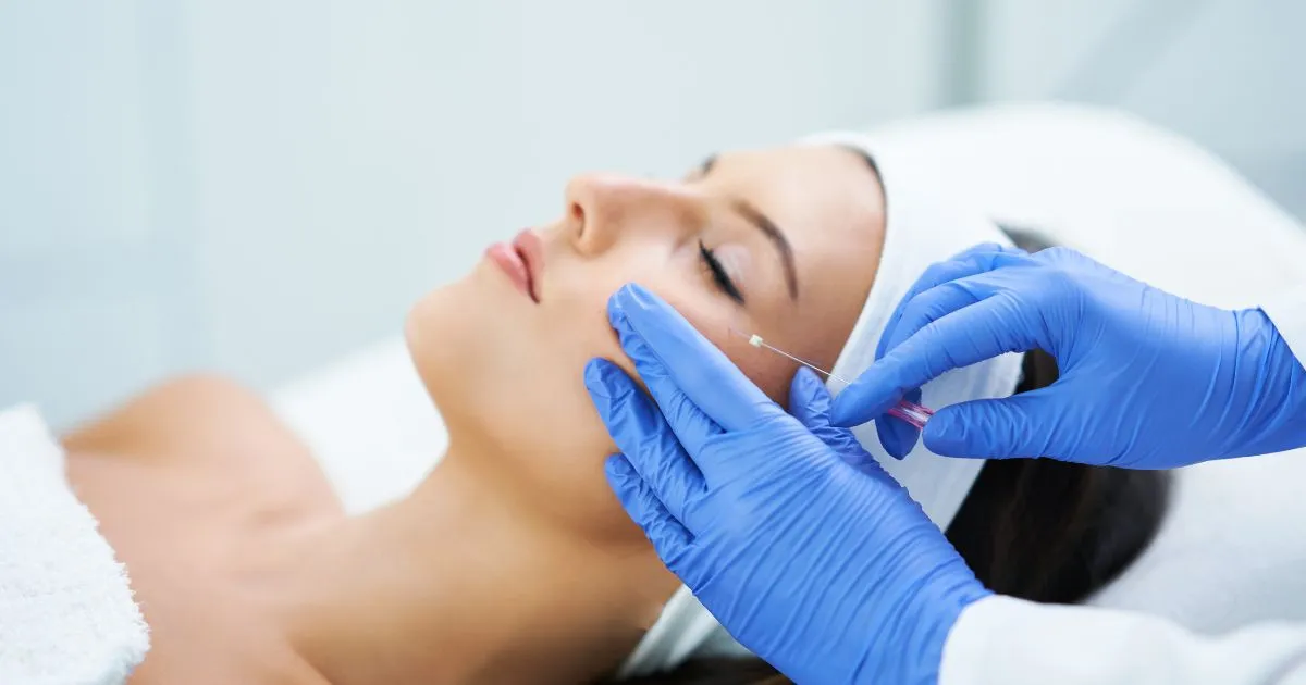 PDO Thread Lifts at Regenerative Aesthetics and Dermatology in Laguna Hills, CA